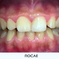 Первичный прием стоматолога. Стоматология Краснодара «Эскулап»